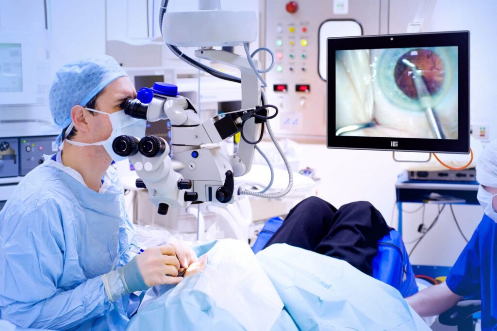 How to Prepare for Cataract Surgery